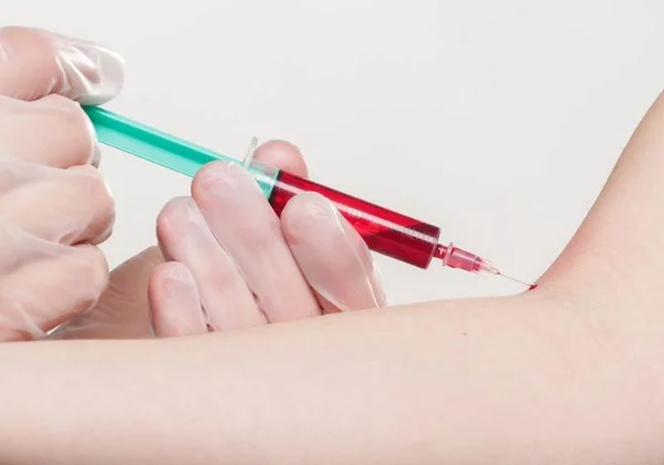 Diabetes tipo 1: cientistas produzem insulina com células-tronco