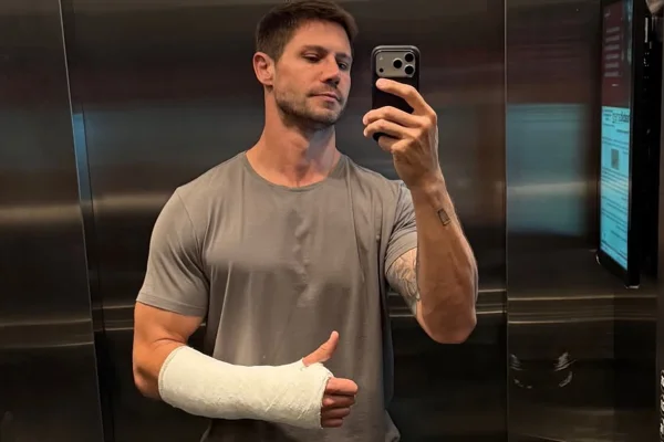 Ex-BBB Jonas Sulzbach relata dificuldades por conta de gesso no braço - Metrópoles