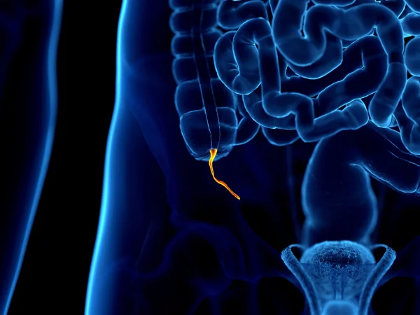 Ilustração mostra a localização do apendice no corpo - Metrpopoles