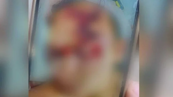 Imagem colorida mostra jovem espancado - Metrópoles