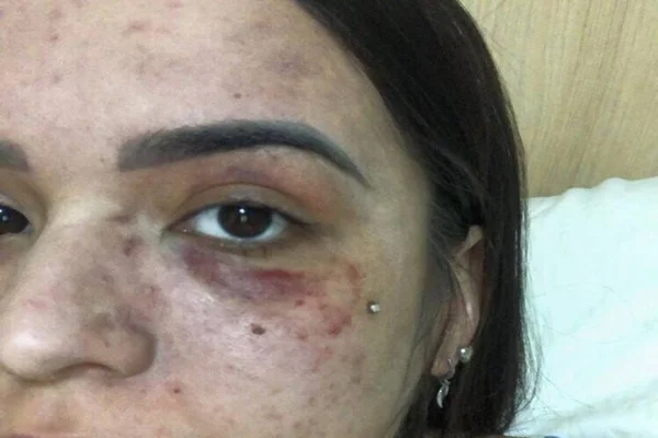 Para ajudar vítimas, jovem do DF relata relacionamento abusivo no Instagram: “Fui humilhada”
