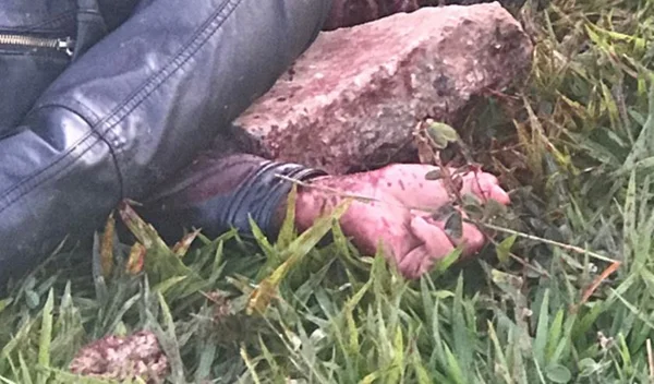 Namorado é suspeito de tentar matar jovem a pedradas após festa
