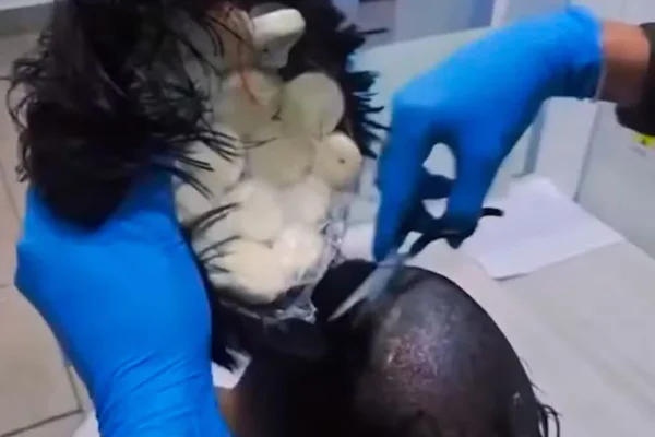 Foto colorida de homem transportando drogas escondidas na peruca - Metrópoles