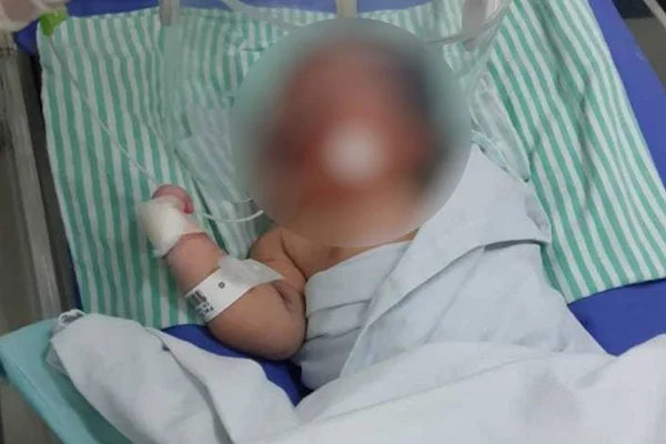 Em Goiânia, mãe é suspeita de tentar asfixiar filha logo após o parto