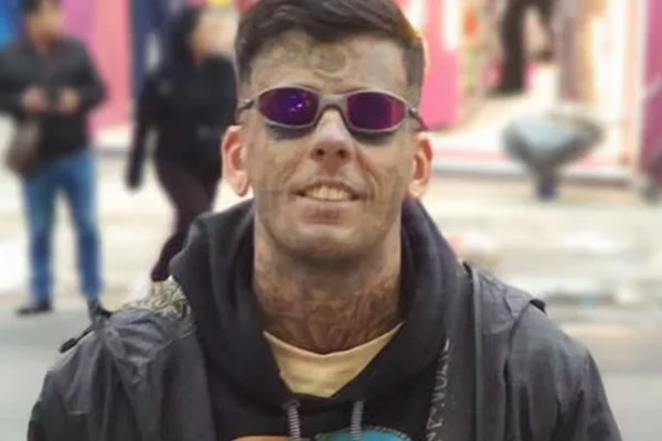 Leandro de Souza começou a remover as tatuagens que fez no rosto ao longo da vida - Metrópoles