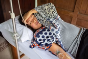 No período de diminuição ou desaparecimento da febre, a maioria dos casos evolui para a recuperação e cura da doença. No entanto, alguns pacientes podem apresentar sintomas mais graves, que incluem hemorragia e podem levar à morte No período de diminuição ou desaparecimento da febre, a maioria dos casos evolui para a recuperação e cura da doença. No entanto, alguns pacientes podem apresentar sintomas mais graves, que incluem hemorragia e podem levar à morte