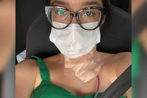 Foto colorida de mulher com máscara , óculos e um tubo fino ligado ao pescoço - Metrópoles.