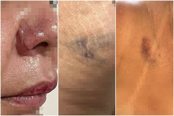 Mulher é agredido com socos e ameaçada te morte