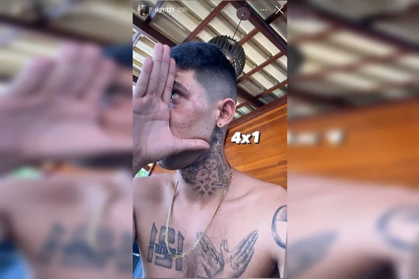 postagem feita pela vítima no instagram mostrando as lesões