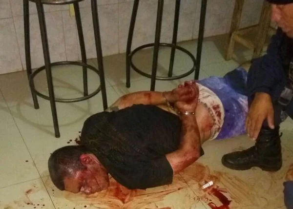 Câmera registra fuga de criminoso que atirou em mulher. Veja o vídeo