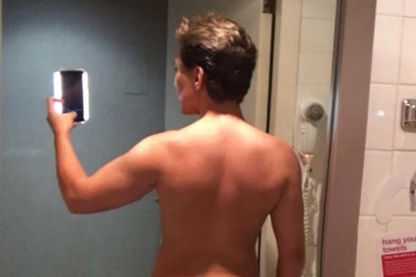 “Ken humano” coloca 2 litros de gordura no bumbum e mostra o resultado