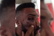 Cliente afirma que foi espancado por seguranças após uma discussão na fila de um bar e diz ter sido alvo de ofensas racistas e homofóbicas Cliente afirma que foi espancado por seguranças após uma discussão na fila de um bar e diz ter sido alvo de ofensas racistas e homofóbicas