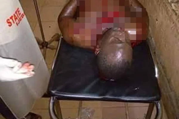 Mulher é presa no DF após esfaquear namorado pela segunda vez