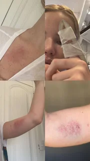 Imagens fortes: amiga mostra Marcela Tomaszewski machucada após agressão de Dado Dolabella
 Imagens fortes: amiga mostra Marcela Tomaszewski machucada após agressão de Dado Dolabella