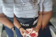 Mulher agredida e amaeaçada Mulher agredida e amaeaçada
