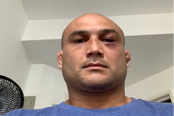 Vídeo: ex-campeão do UFC, BJ Penn vai a nocaute em briga de rua
