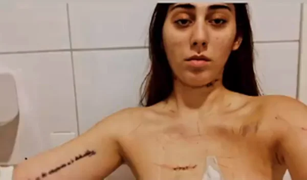 Mulher mostra agressões causada por jogador