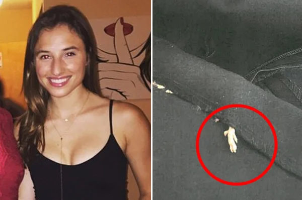 Americana acha rato morto costurado em vestido comprado na Zara
