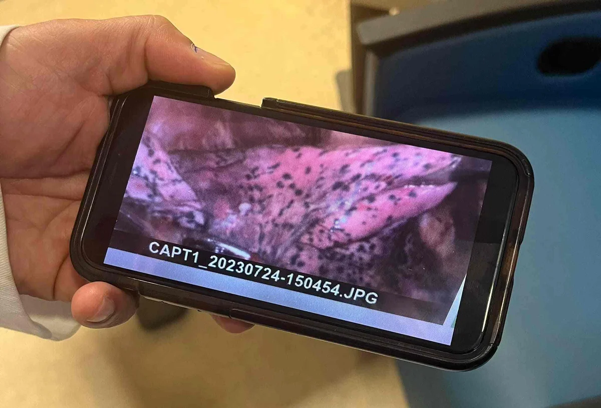 Pulmão de jovem ficou coberto de manchas pretas Pulmão de jovem ficou coberto de manchas pretas