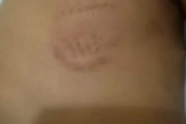 Imagem colorida de menino de 4 anos agredido pelo pai