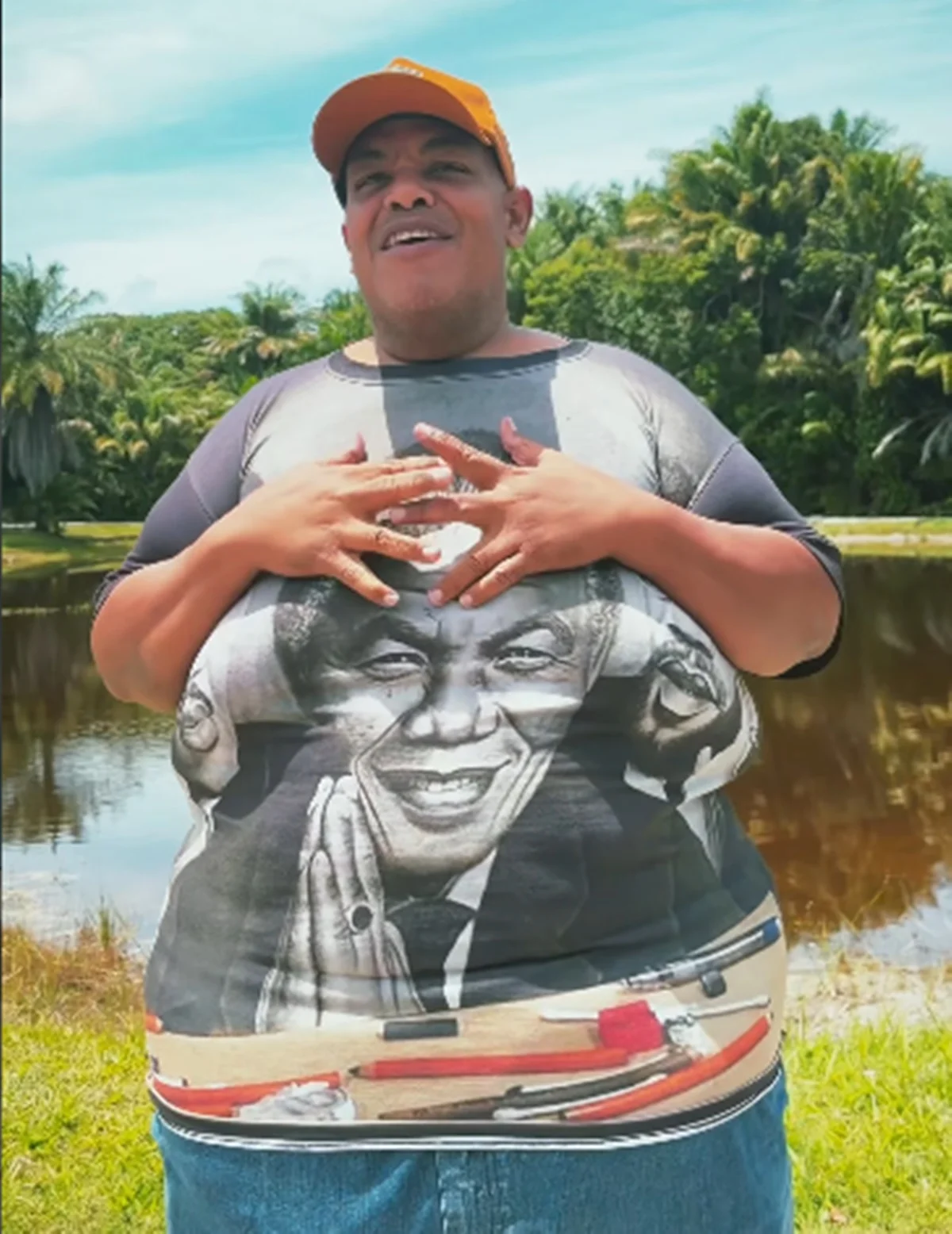 Bariátrica de Luciano Babu foi um sucesso Bariátrica de Luciano Babu foi um sucesso