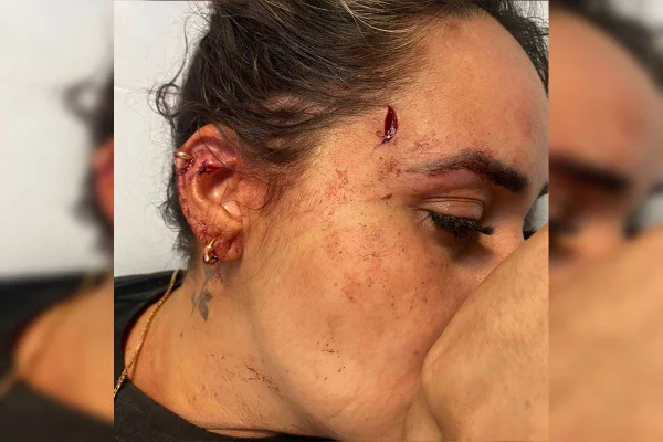 Copo quebrado no rosto de mulher: vídeo mostra início de confusão