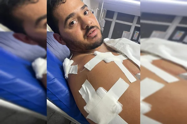 Homem deitado olha de lado com curativos pelo corpo