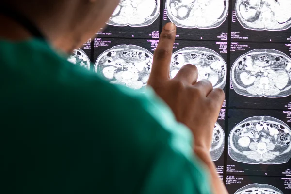 Imagem colorida de uma médica analisando raio-x de cérebro - Metrópoles