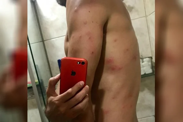Vídeo. Enxame de abelhas ataca pessoas durante festa no Bay Park