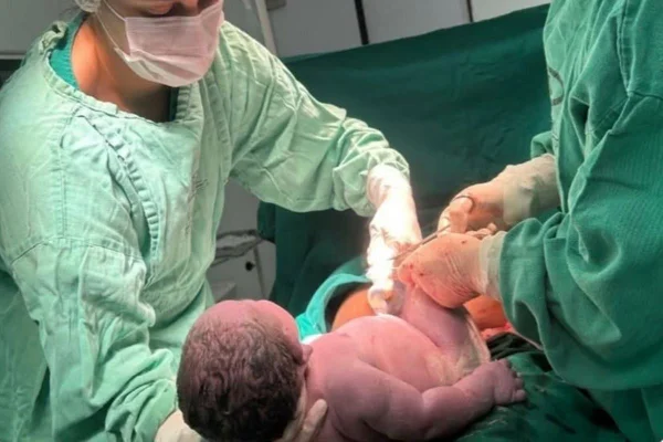Imagem colorida do Bebê Gigante