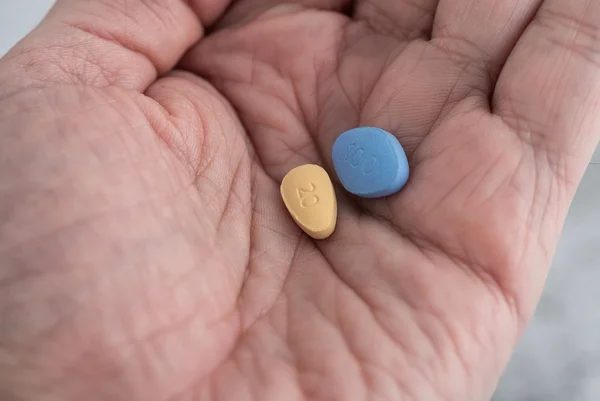 Duas pílulas azuis e marrons na mão masculina. Conceito de medicina de viagra e cialis. Saúde masculina, medicação para ereção. Tadalafila