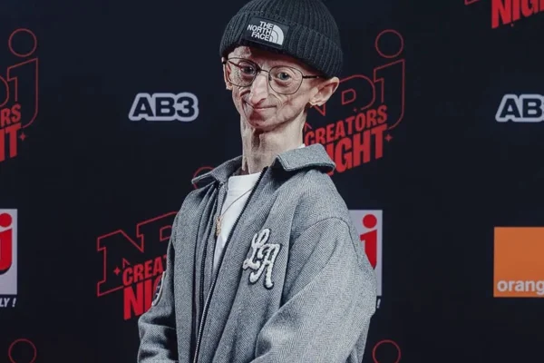 Morre, aos 28 anos, Michiel Vandeweert, influenciador com doença genética rara - Metrópoles