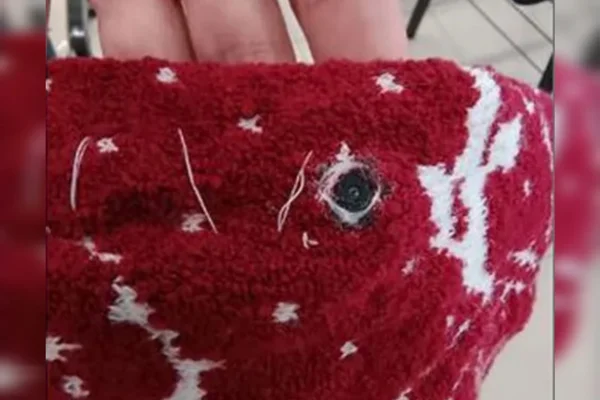 Imagem de tecido com câmera pequena acoplada usada por Nadine em concurso - Metrópoles