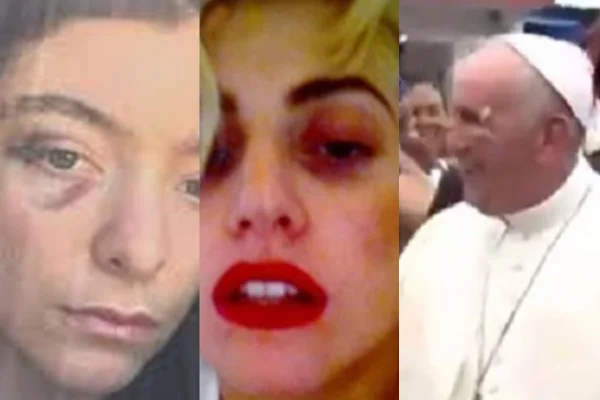 Lorde, Lady Gaga e até Papa Francisco estariam em seita secreta do Olho Roxo