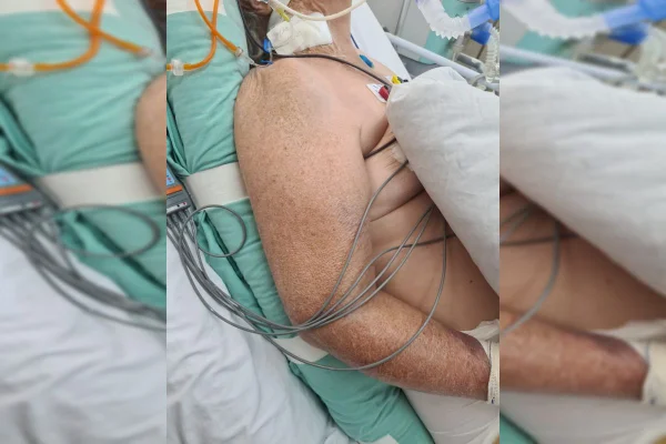 Morre idosa que esperou nove dias por vaga em UTI no DF