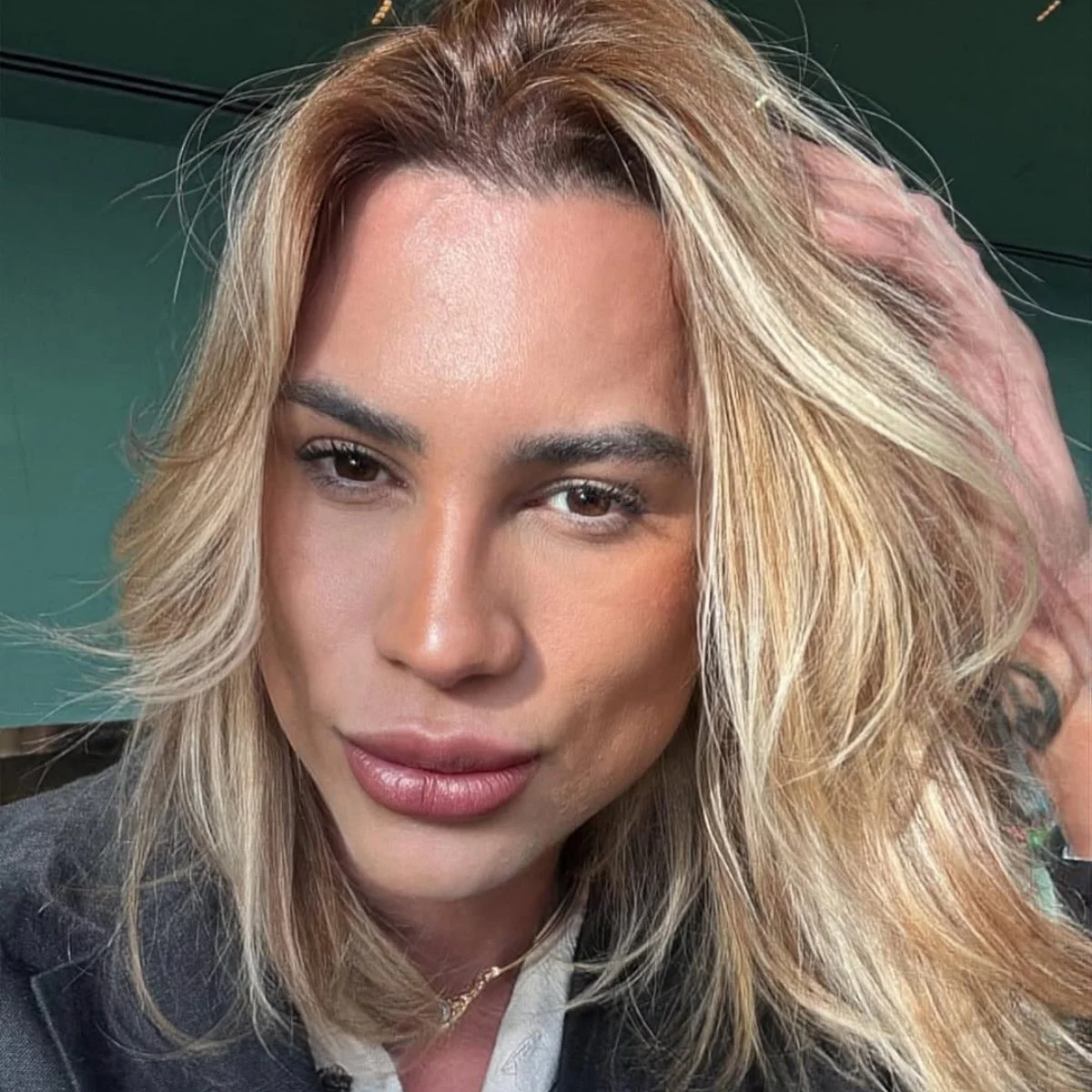 influenciador morre apos procedimento estetico 2