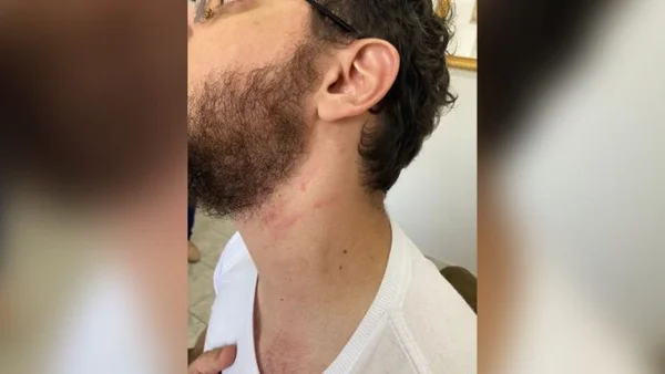 MPF processa por abuso de poder delegado que agrediu professor