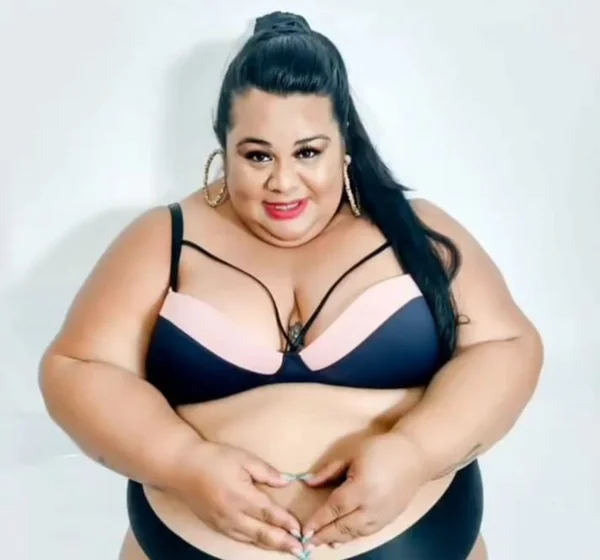 Parto de Jhuly Amorim, paciente com obesidade grave
