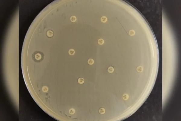 Imagem mostra cultura de microrganismo Antibiograma de Klebsiella pneumoniae - Metrópoles
