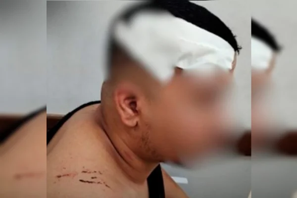 Jovem é agredido com madeira ao jogar truco em GO