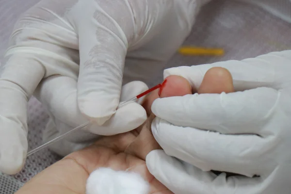Foto colorida de amostragem de sangue para medida de diabetes - Metrópoles.