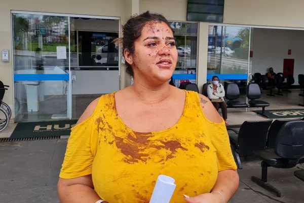 Maressa Jordana, 21 anos, sobrevivente de acidente de ônibus em Goiás