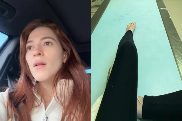 Ana Clara sofre acidente em viagem e atualiza seguidores sobre saúde
