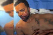 Adonis Martins foi detido pela PMDF e responde por lesão corporal grave, importunação sexual e perseguição Adonis Martins foi detido pela PMDF e responde por lesão corporal grave, importunação sexual e perseguição