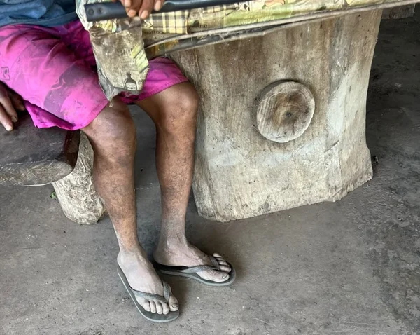 Imagem colorida dos pés de Sebastião - Metrópoles
