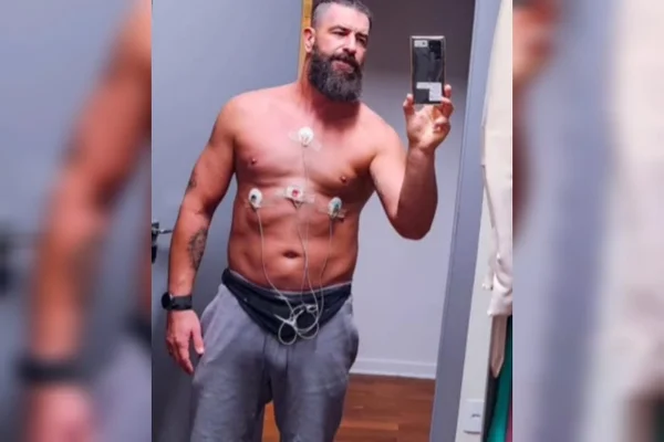 Educador físico sofre AVC aos 46 anos. Entenda caso Giulliano Esperança atribui aos hábitos saudáveis sua recuperação expressiva em apenas um mês, mas ainda enfrenta sequelas