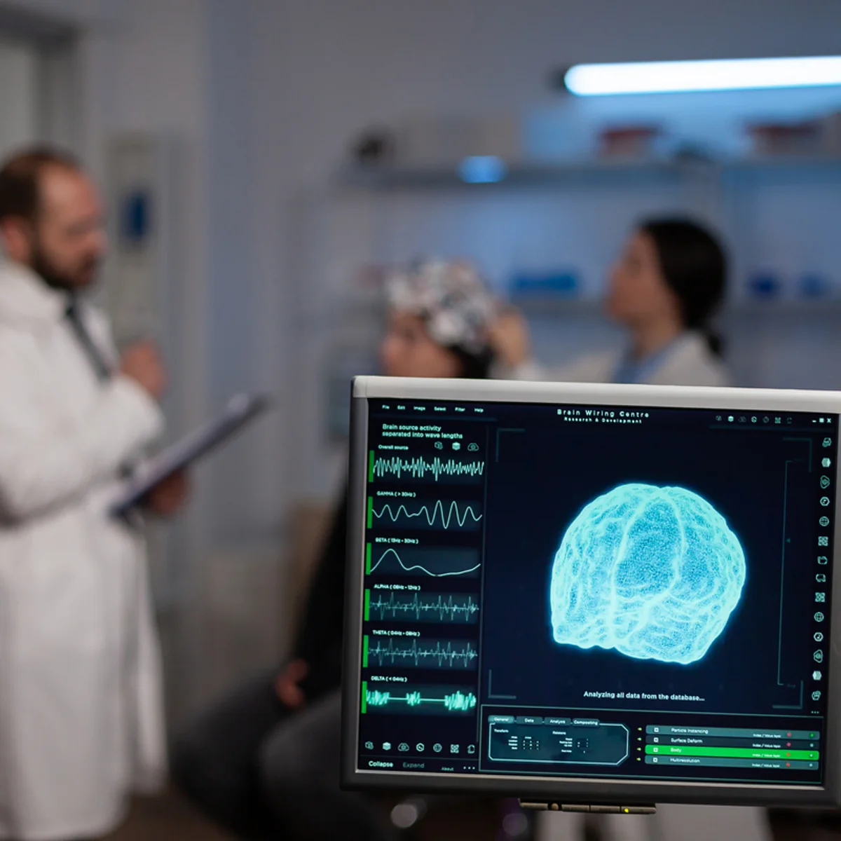 Alzheimer: estudo identifica ondas cerebrais que podem ajudar a prever risco da doença