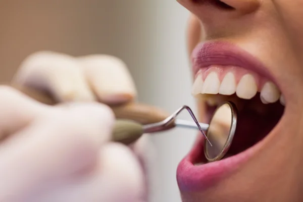 Imagem colorida de pessoa no dentista - Metrópoles