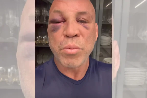Foto colorida de Wanderlei Silva - Metrópoles
