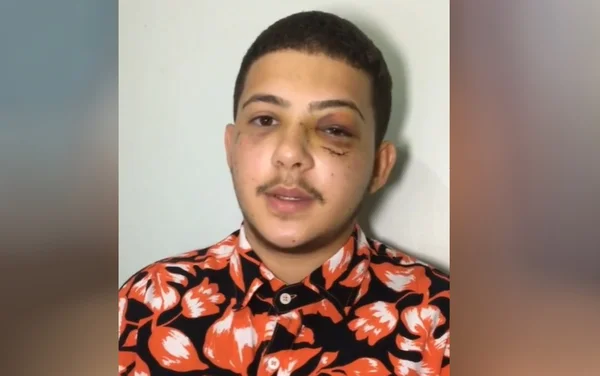 goias jovem diz que foi agredido a socos por cantor sertanejo